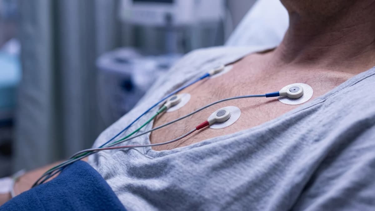 Adhesive monitoring electrodes and lead wires on an adult chest, face out of frame