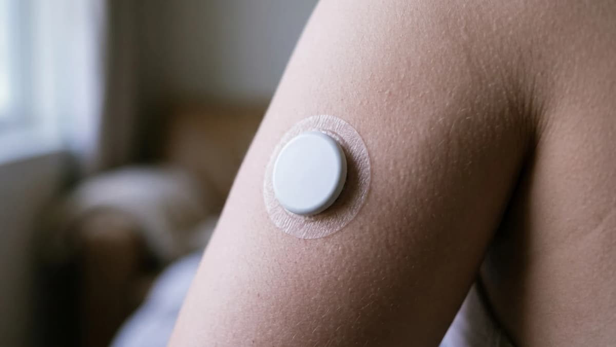A small round continuous glucose sensor adhered to the back of an upper arm